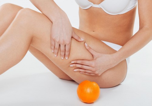 Massage-gegen-Cellulite